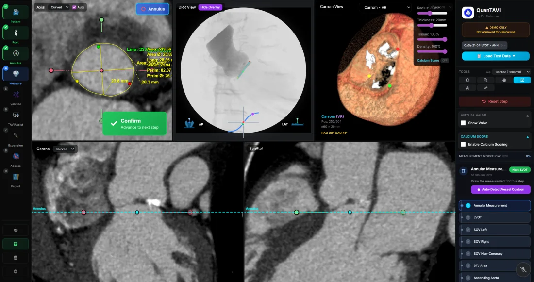 QuanTAVI aortic valve planning workspace